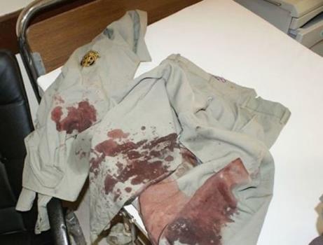 انتقال قرقبان مصدوم سمنانی به تهران