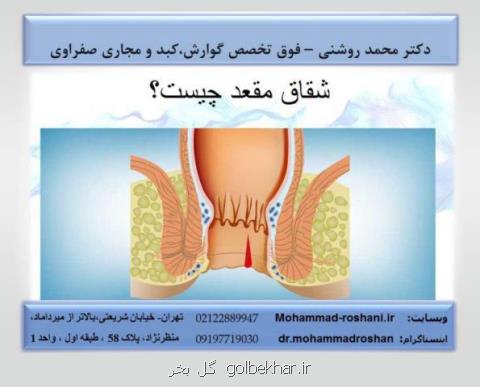 انجام آندوسكوپی و كولونوسكوپی